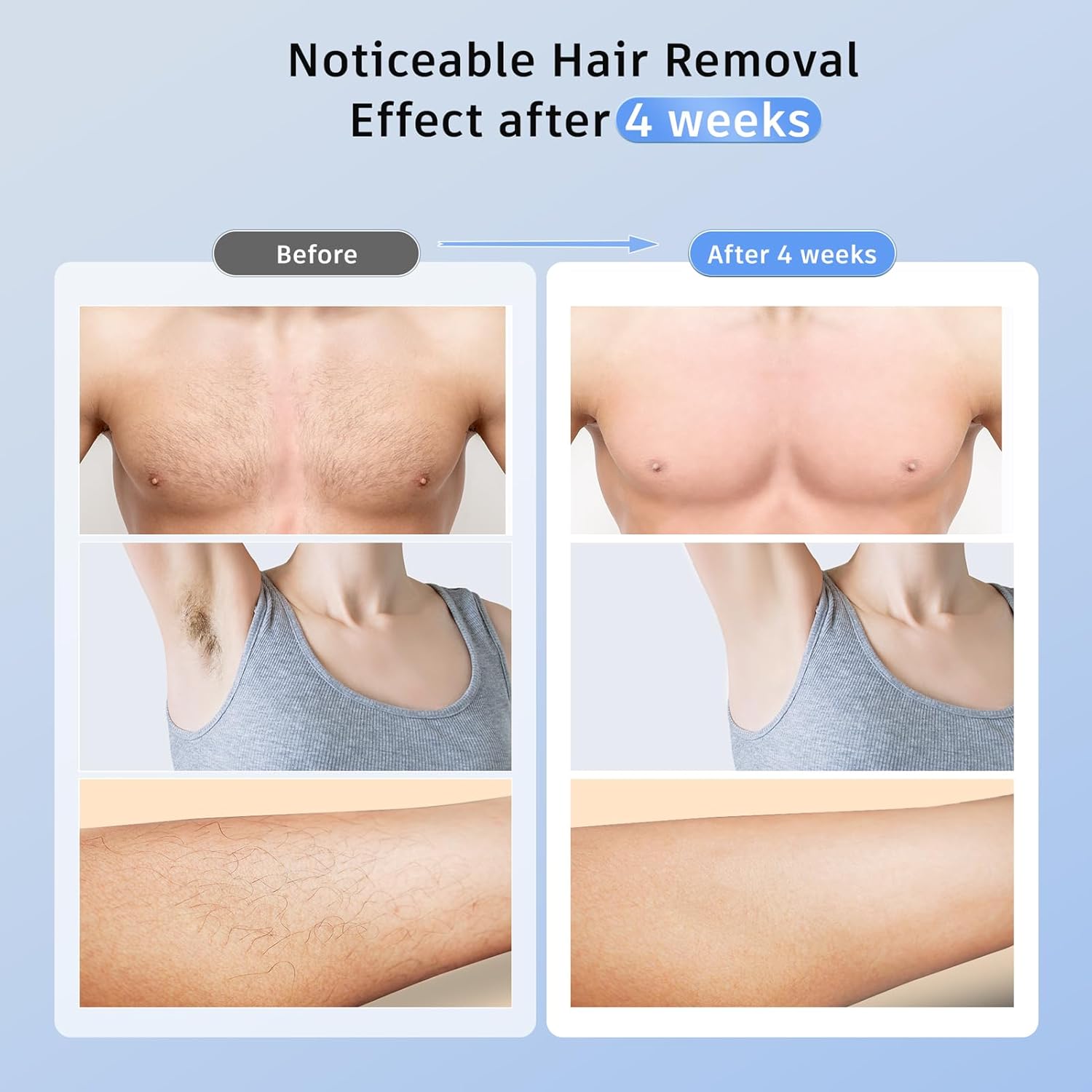 71Cu7ybegeL._SL1500_ Ubroo IPL Hair Removal Device - Image 2